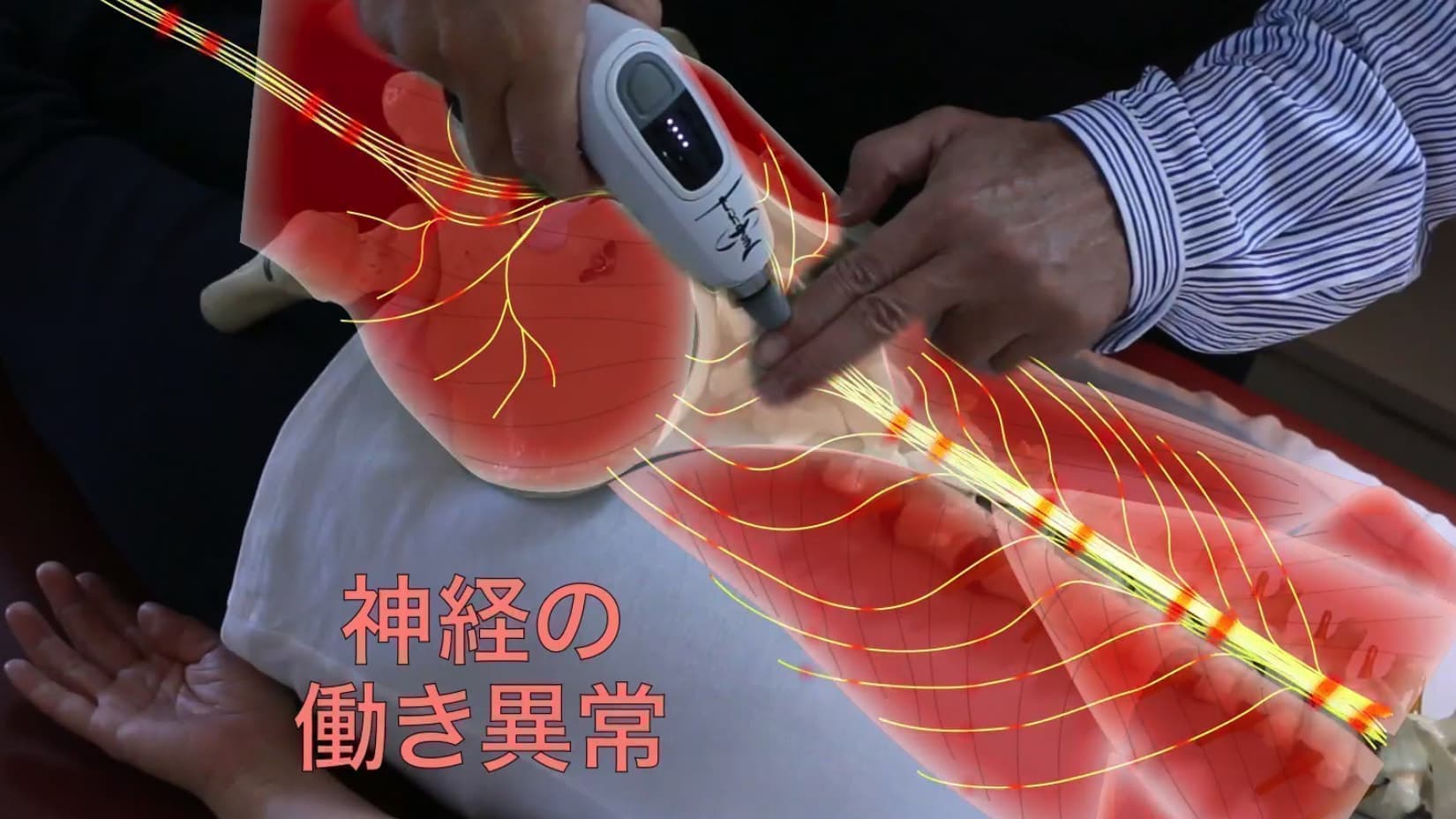 Before adjustments of spine｜Dysfunction of nervous system and muscles｜Family Chiropractic Center｜Fukuoka