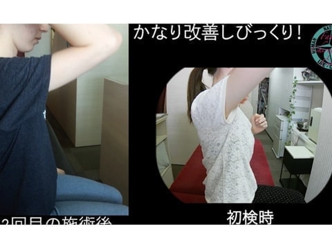 送球イップス｜局所性ジストニア｜ファミリーカイロプラクティックセンター福岡