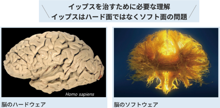 イップス｜治すために必要な理解｜神経系の電気信号の問題｜ファミリーカイロプラクティックセンター福岡