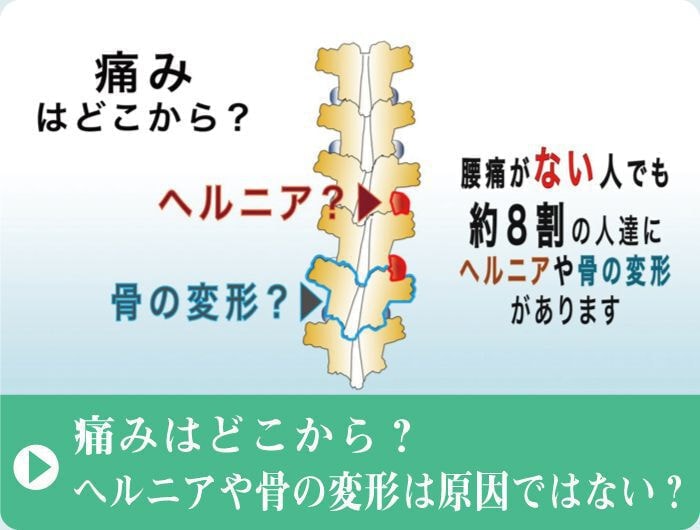 痛みはどこから｜動画を見る｜ファミリーカイロプラクティックセンター福岡